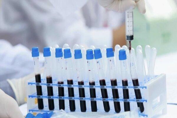 دومین بیمار اچ آی وی به طور کامل بهبود پیدا کرد